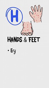 135K views · 2.1K reactions | Code HAVIC @medschoolbro = Mystery...