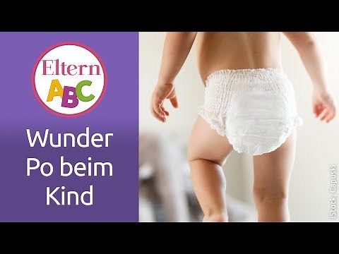 Wunder Po beim Kind: Was ist zu tun und wie kann ich das verhindern? | Baby | Eltern ABC | ELTERN
