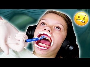 Braces VS Invisalign Battle OVER!!