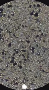 The Secret Life of Yeast Revealed Under the Microscope