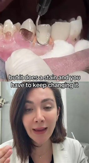 How Does Dental Cavity Happen In Between Two Teeth?!