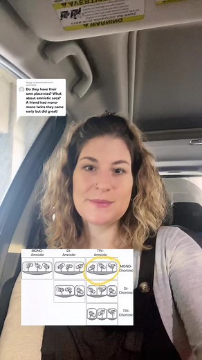 Understanding Identical Twins: Separate Sacs and Placentas Explained