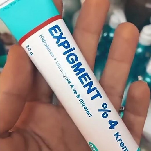 Expigment Cream 4% Hydroquinone Skin Melasma chloasma