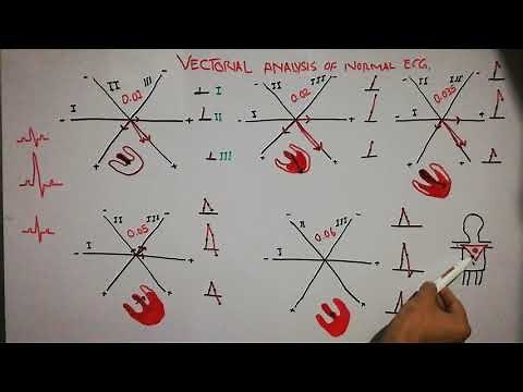 CVS physiology 29. Vectorial analysis of normal QRS complex, normal ECG. how QRS complex is formed.