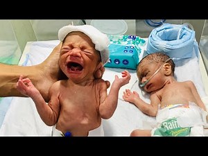 Premature Twin Babies’ First Feeding in NICU | Emotional Moments 😉