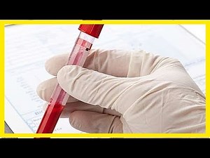 Wofür ist die CPK-Prüfung?