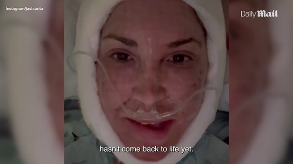 Real Housewives star Jacqueline Laurita checks in after full facelift surgery