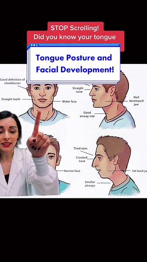 Yes it’s true! Your tongue posture and whether you breathe through your nose or your mouth will affect your facial development and overall facial structure! Breathing through your nose and having your tongue up against the roof of your mouth with a light suction is ideal. This will lead to wide open airways, which will allow for better breathing and better sleeping and will help you avoid TMJ dysfunction. ##headacherelief##lockedjaw##tmj##jawpain##tongueposture##mouthbreathers##foryoupage##fypシ#