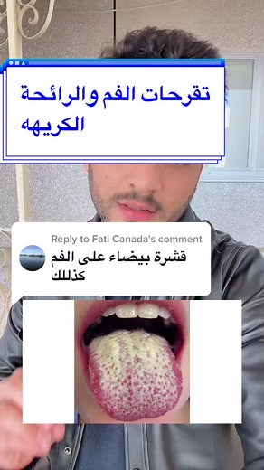 تقرحات الفم ورائحة الفم الكريهة: الأسباب والعلاج