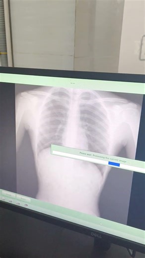 ORICH X-ray machine repair done #mset20 #lifeisbutadream