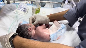 Newborn LBW Baby | Critical Condition at Birth | Delay Cry, IV Line, Emergency Dose | NICU Care #video #newborn #niculife #trending | Anoop Gautam