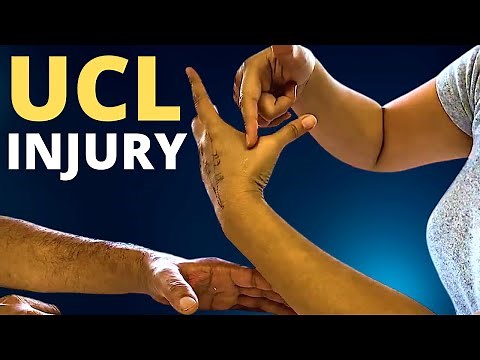 Ulnar Collateral Ligament (UCL) Thumb Injury Assessment & Precautions