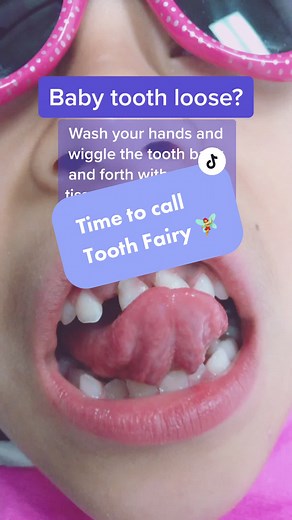 How to Remove a Loose Baby Tooth: Tips and Solutions