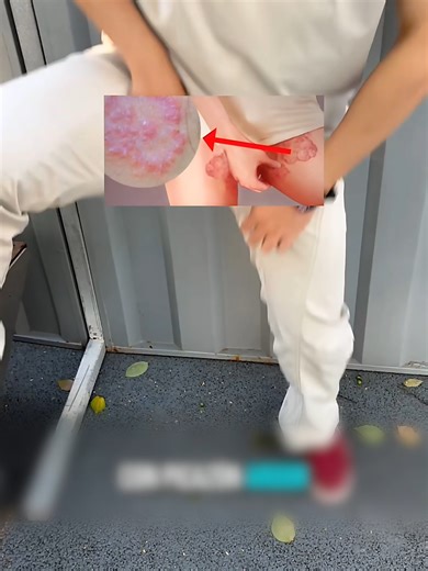 Men's Skin Nightmares: Itching, Swelling, and Redness