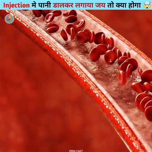 What will happen if water is added to the injection? 🤯