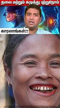 Head and Neck Cancer – Causes?? | Dr Vignesh ENT