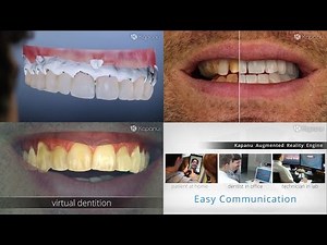 Kapanu | Augmented Reality for the Future of Dentistry