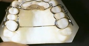 Feds launch criminal investigation into "AGGA" dental device and its inventor