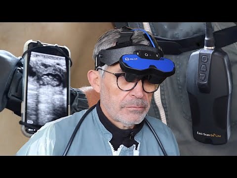 Easi-Scan:Go Lite ultrasound scanner
