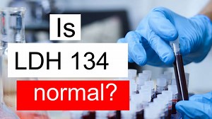 Is LDH 134 normal, high or low? What does Lactate dehydrogenase level 134 mean?