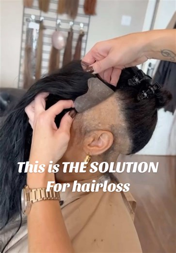 Transforming Lives with Hair Loss Solutions