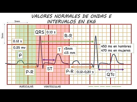 NORMAL ELECTROCARDIOGRAM. THE DEFINITIVE GUIDE!!!