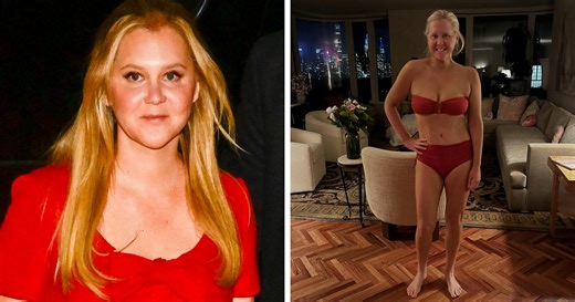 Amy Schumer’s Bikini Shots Stun After Major Weight Loss Transformation