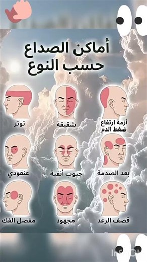 🧠⚡ أماكن الصداع في الرأس وماذا قد تدل عليه؟ ⚡🧠