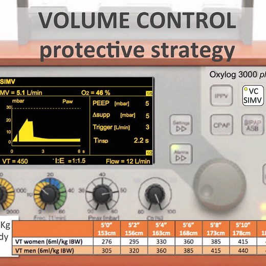 Own The Oxylog 3000 Plus! - ED Procedures