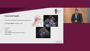 Advanced Intraoperative Monitoring for Aortic Arch Surgery: Beyond Standard Practice
