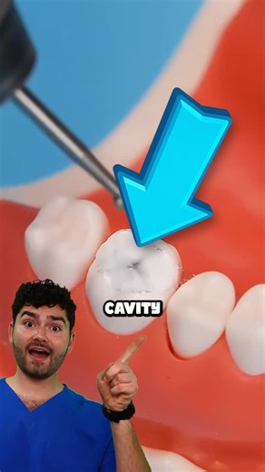 Dental Digest on Instagram: "How To Fix Cavities!? #dentist #satisfying #toothpaste #mouthwash #health"