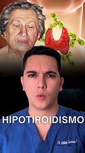 Hipotiroidismo: causas, síntomas y tratamiento. | Dr. William Guerrero