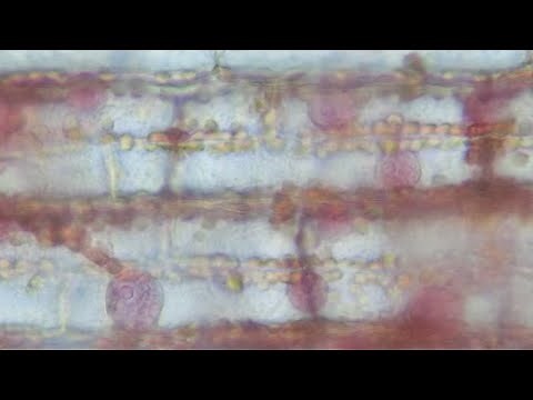 オオカナダモの核の染色方法～前処理なしで簡単に～