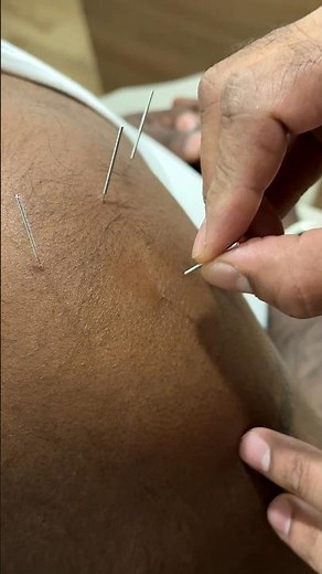 Muscle Spasm & Shoulder Pain Relief 💪✨ Instant Mobility Fix!