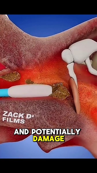 Ear Wax Remover with Camera Under $20