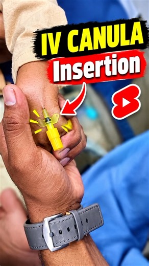 IV Cannula insertion | Step-by-Step Demonstration | tutorial