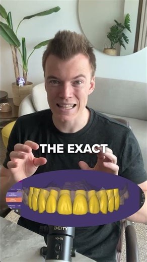 New Tooth Adjustment Feature