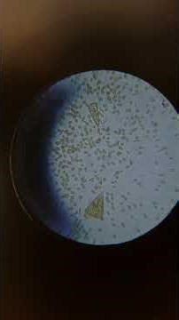 Diatoms vs. Dino? What’s Growing in My Saltwater Aquarium (Microscope)