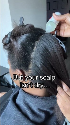 This is why your scalp is dry