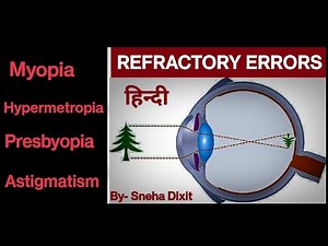 Refractive Errors in Hindi!!