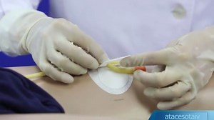 Watch How is Catheter Stabilization Device working on Amazon Live