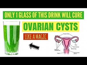 How to get rid of ovarian cysts naturally and fast without surgery – Home remedies for treatment