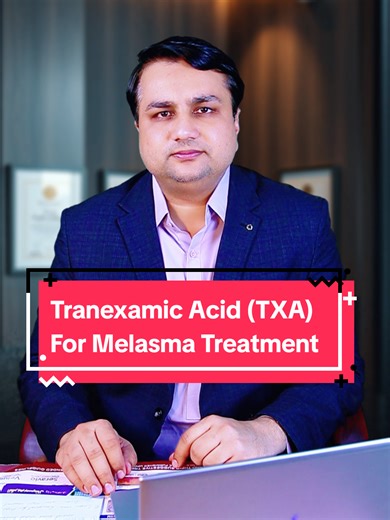 Tranexamic Acid: Capsule vs. Serum for Melasma Treatment