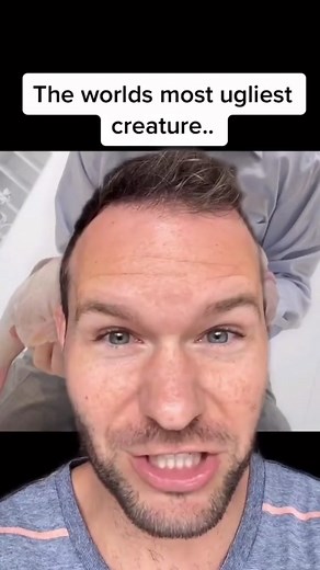 The worlds ugliest creature. #creature #crazy #weird