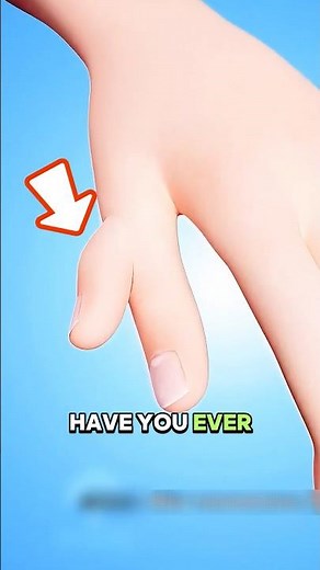 The Truth Behind Extra Fingers or Toes