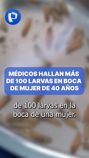 ➡ La mujer de 40 años fue diagnosticada con miasis oral, una grave condición causada por la infestación de larvas en tejidos muerts. #PanamericanaTelevisión #miasisoral #boca #larvas | Panamericana Televisión