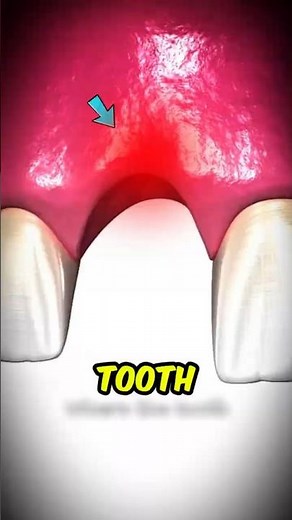 If You Ever Wondered What Happens After You Lose a Tooth…😅