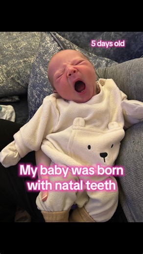 Understanding Natal Teeth in Newborns: Brodie's Story