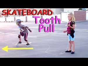 👄🏂Tooth PULLED OUT with SKATEBOARD☠