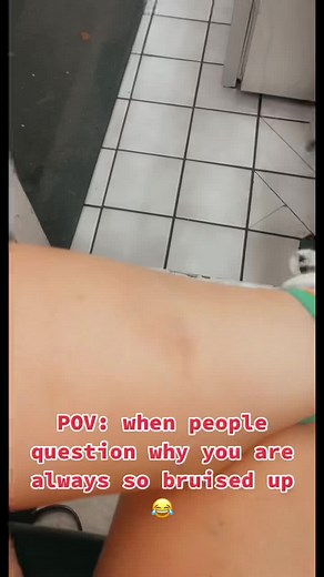 a fractured tail bone later 😂😂 #fyp #clumsy #worklife